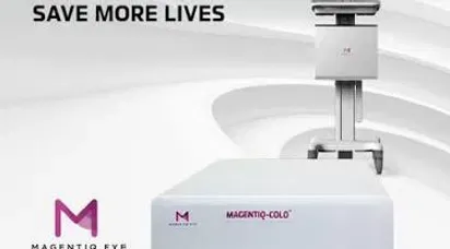 MAGENTIQ-COLO™ screen image showing an AI polyp detection overlay